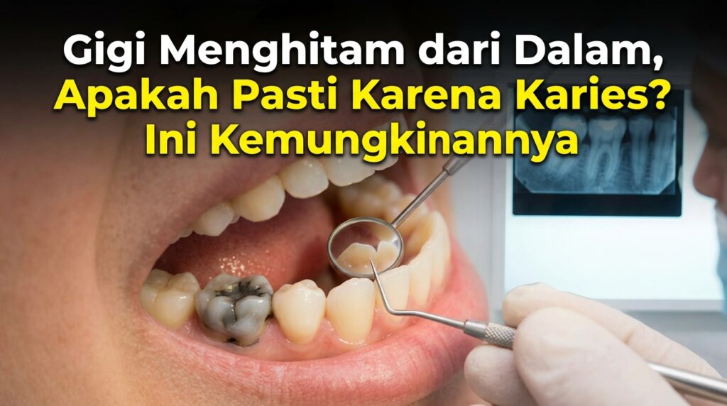 Gigi Menghitam dari Dalam, Apakah Pasti Karena Karies? Ini Kemungkinannya